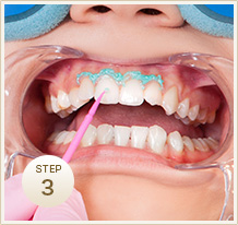 STEP3